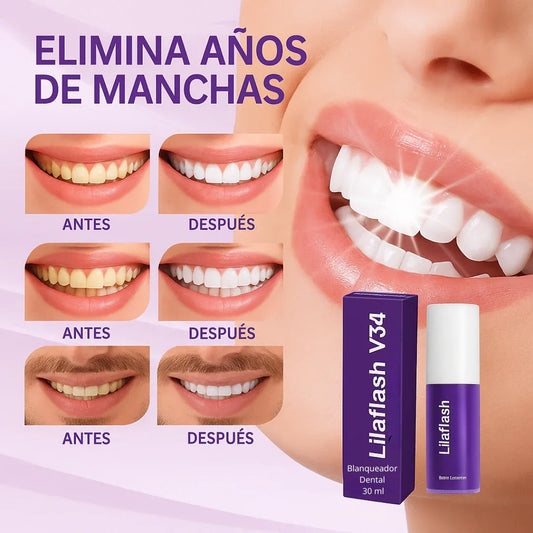 LilaFlash V34 - Blanqueador Dental: Sonrisa Brillante en Minutos